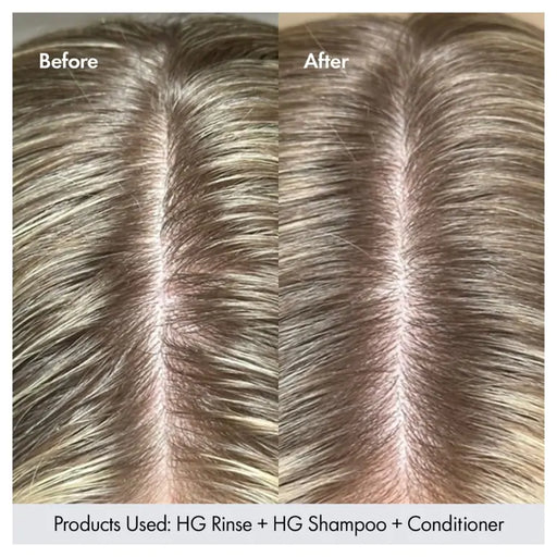 Bondi Boost Hair Growth Clarifying Rinse